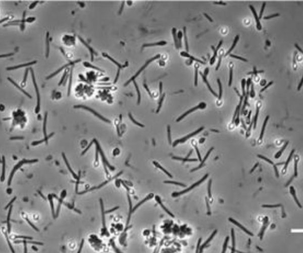 MECADAPT : thèse pour mieux connaître la physiologie de la bactérie d’altération Moorella