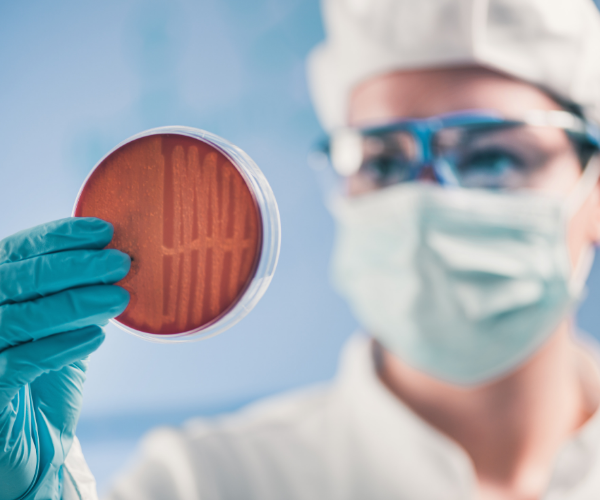 Microbiologie et agent pathogène : détection des salmonelles dans les matrices alimentaires